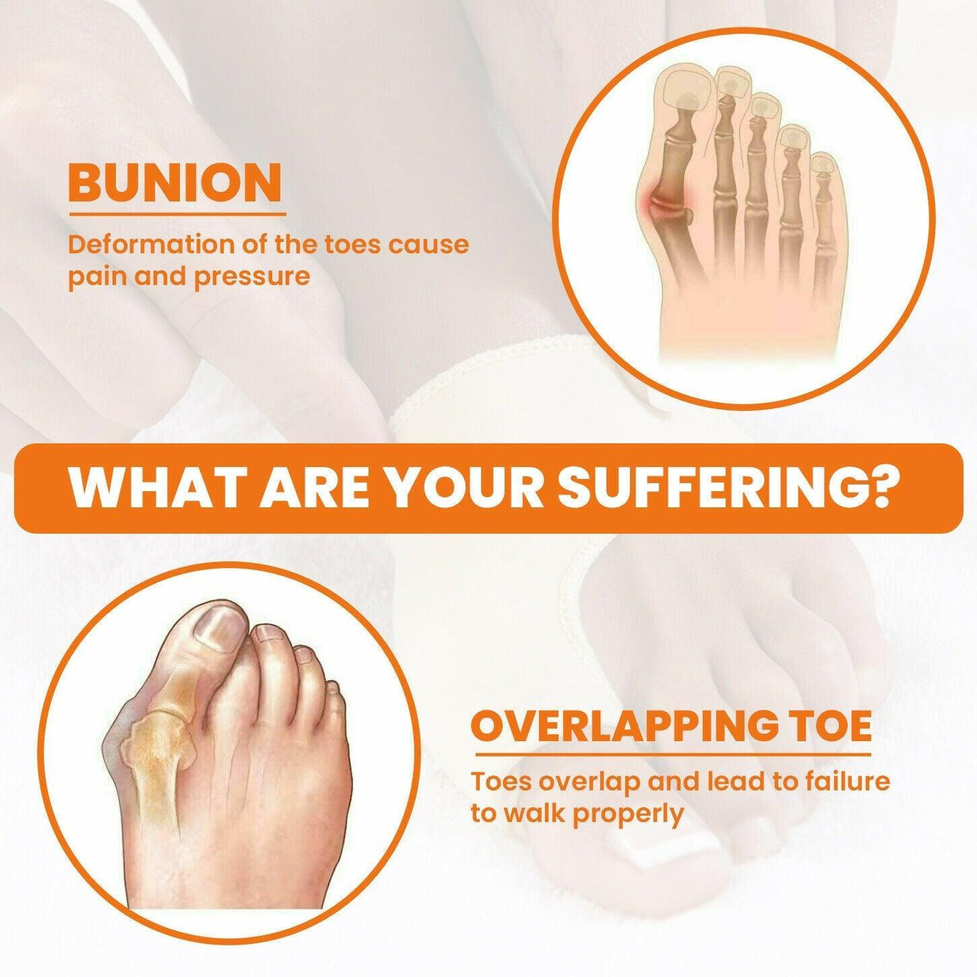 1 Pair Bunion Splint Big Toe Straightener - ItemBear.com