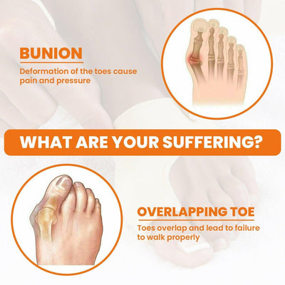 1 Pair Bunion Splint Big Toe Straightener - ItemBear.com