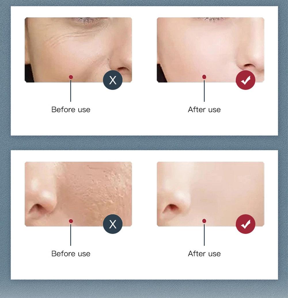 7 Colors LED Facial Mask PDT Light Therapy - ItemBear.com