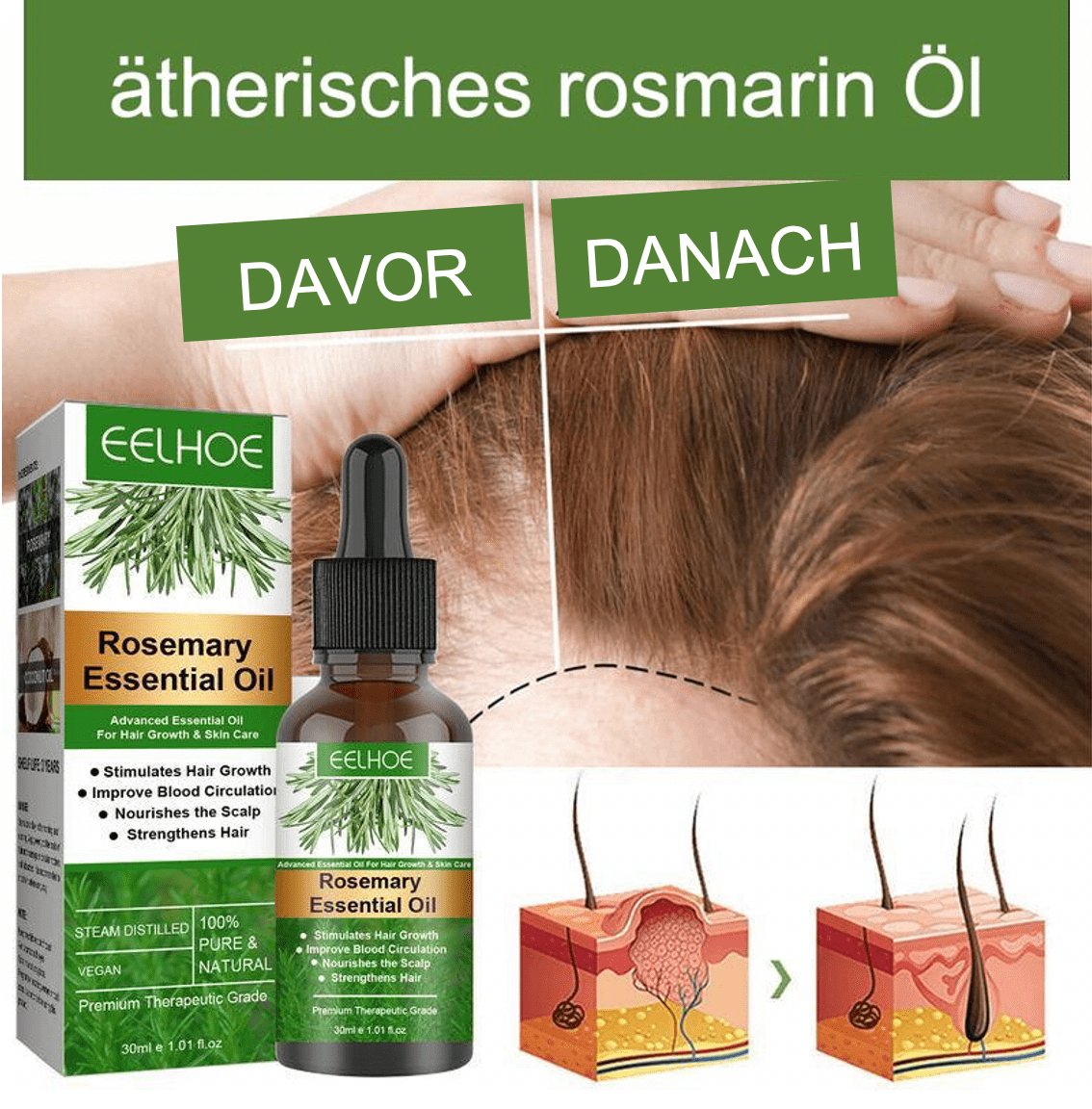 Care Clear Rosemary Oil - ItemBear.com