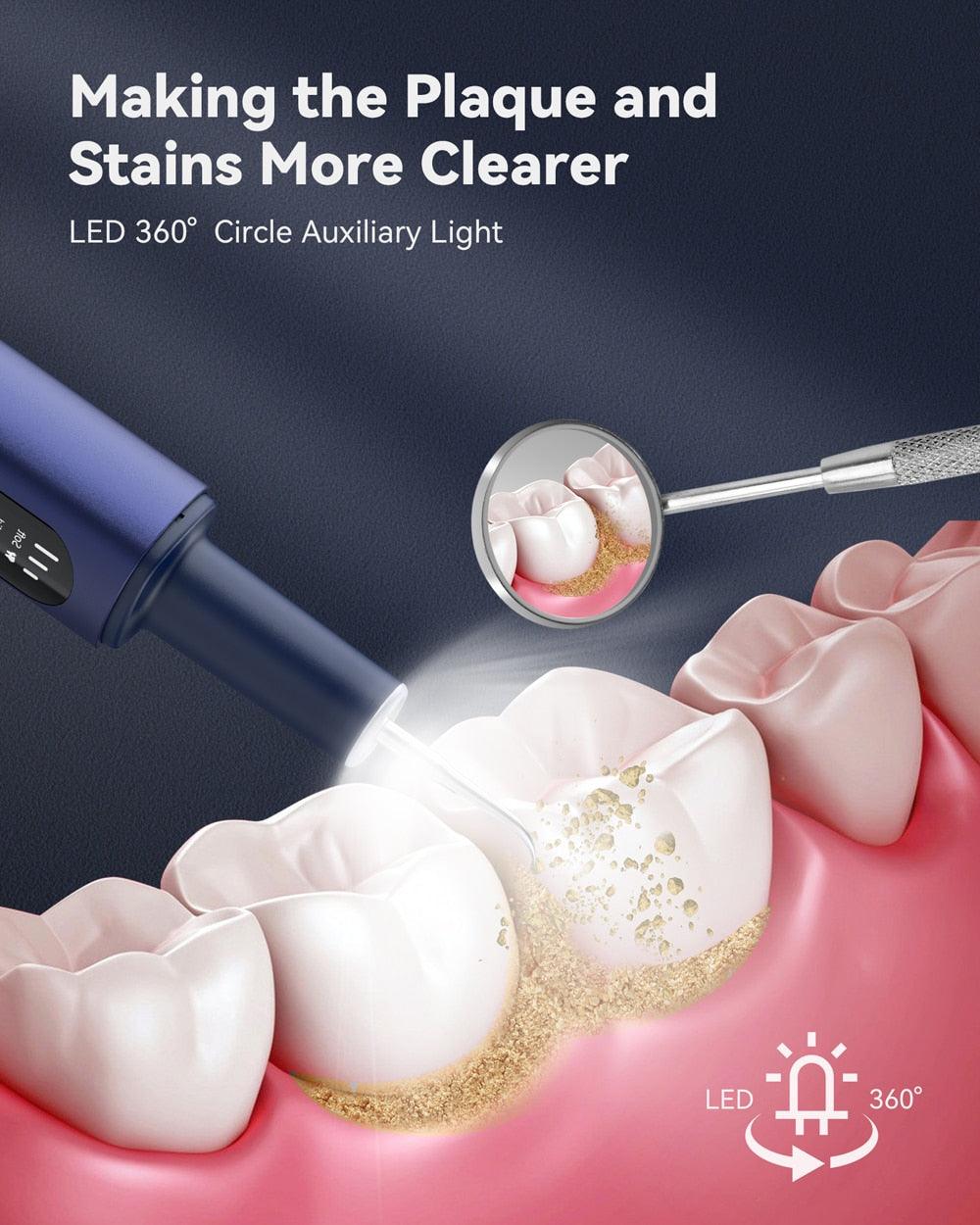 NICARE Ultrasonic Dental Scaler Dental Washer USB Rechargeable Sonic Teeth Tartar Calculus Plaque Remover Teeth Whitening Clean - ItemBear.com
