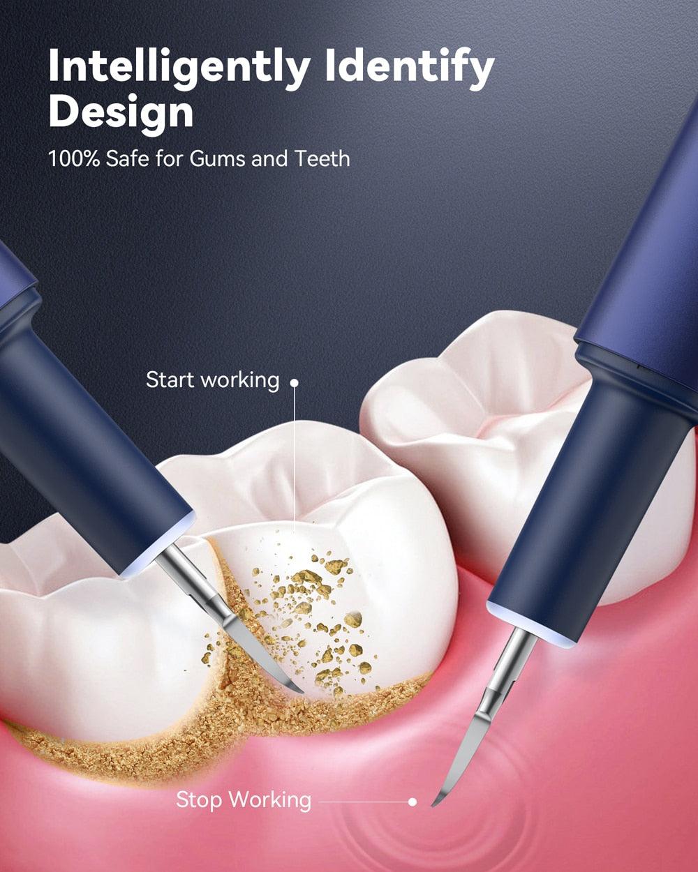 NICARE Ultrasonic Dental Scaler Dental Washer USB Rechargeable Sonic Teeth Tartar Calculus Plaque Remover Teeth Whitening Clean - ItemBear.com