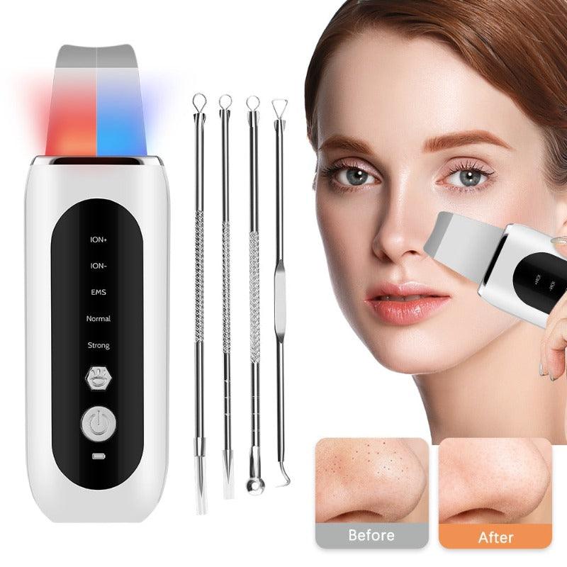 Ultrasonic Face Skin Scrubber - ItemBear.com