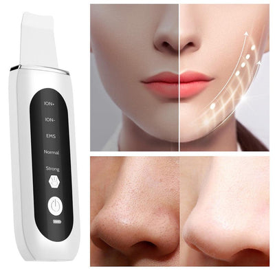 Ultrasonic Face Skin Scrubber - ItemBear.com